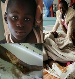 A crocodile in Gwayi River attached this boy.